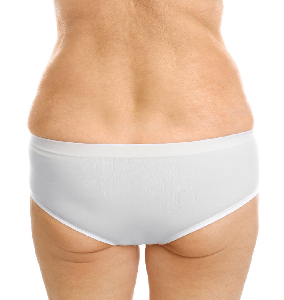 What is the Brazilian Butt Lift Surgery